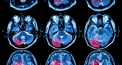 Revolutionizing Cancer Care: The Power of Artificial&nbsp;Intelligence