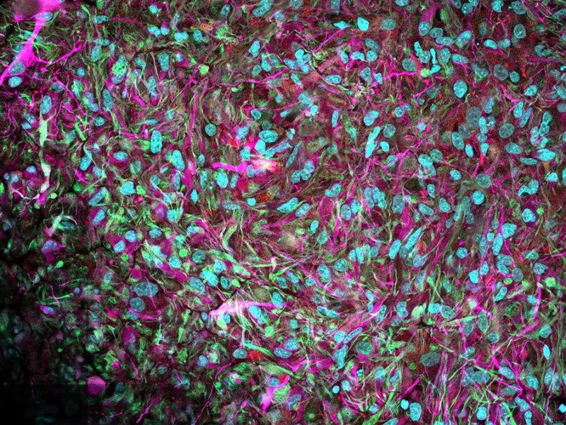 Replacing the A in AI: Unleashing the Power of Miniature&nbsp;Minds