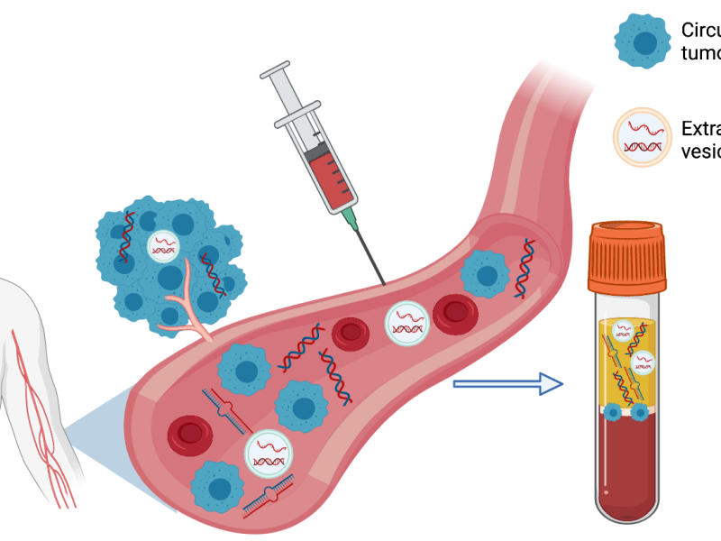 Liquid Biopsy & Non-Invasive Cancer&nbsp;Screening