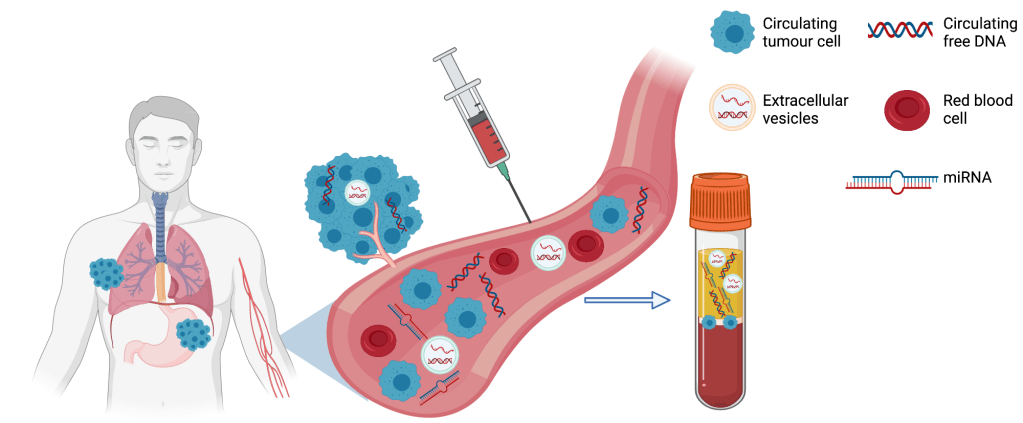 Liquid Biopsy & Non-Invasive Cancer&nbsp;Screening